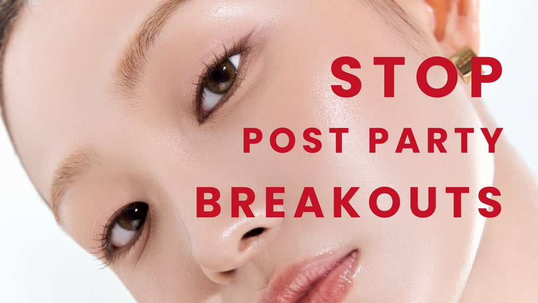 Image of a woman with flawless, dewy K-Beauty glass skin, looking refreshed. Overlaid text reads 'STOP POST PARTY BREAKOUTS', signifying effective skincare for a radiant complexion after events and holidays.
