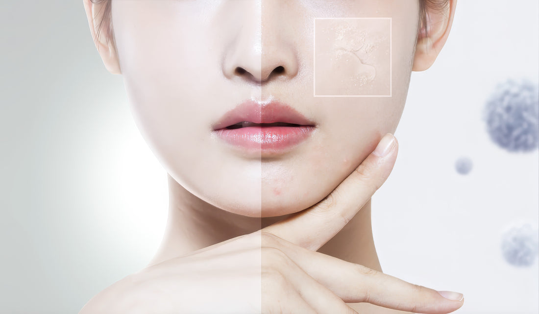 Gentle Exfoliation: A Guide for Sensitive Skin