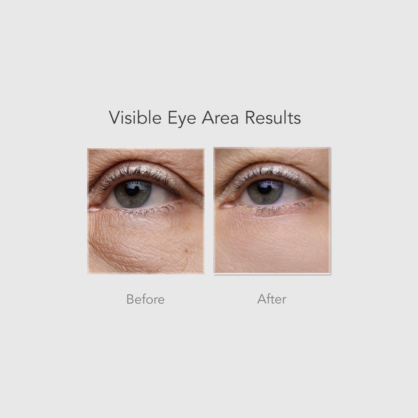 PDRN+ 2% Flat Eyebag Cream