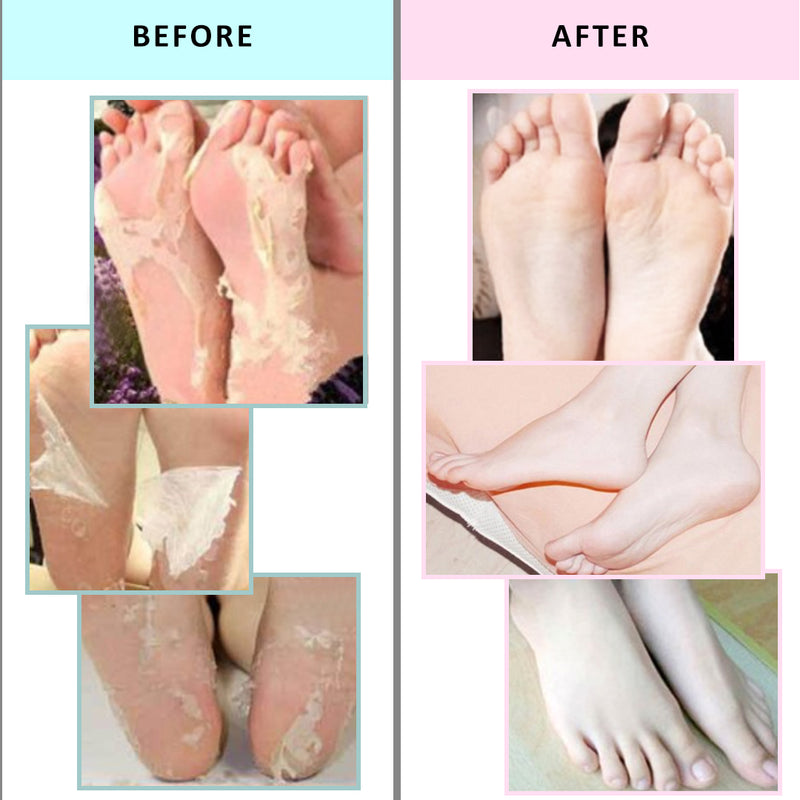 Essential Wonders I Peel Good! Foot Peeling Mask